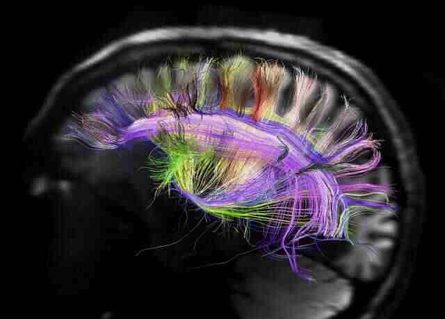 Diffusion spectrum MR image of human brain with colors.